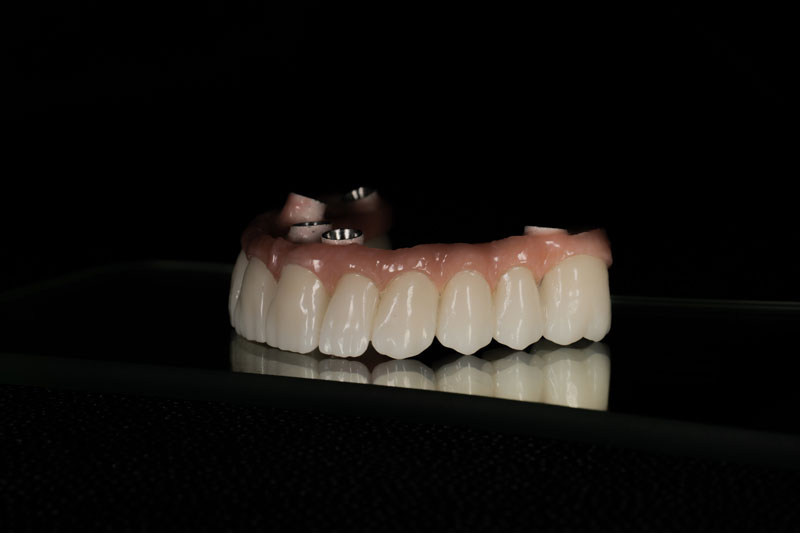 a full arch of zirconia teeth with holes for implants to be placed